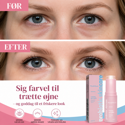 West & Month Øjenbalsam med hyben - Få op til 87 % fastere og løftede øjenlåg på blot 2 timer