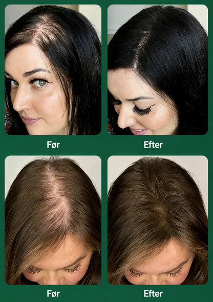 RootRevive™ Økologisk Rosmarinshampoo