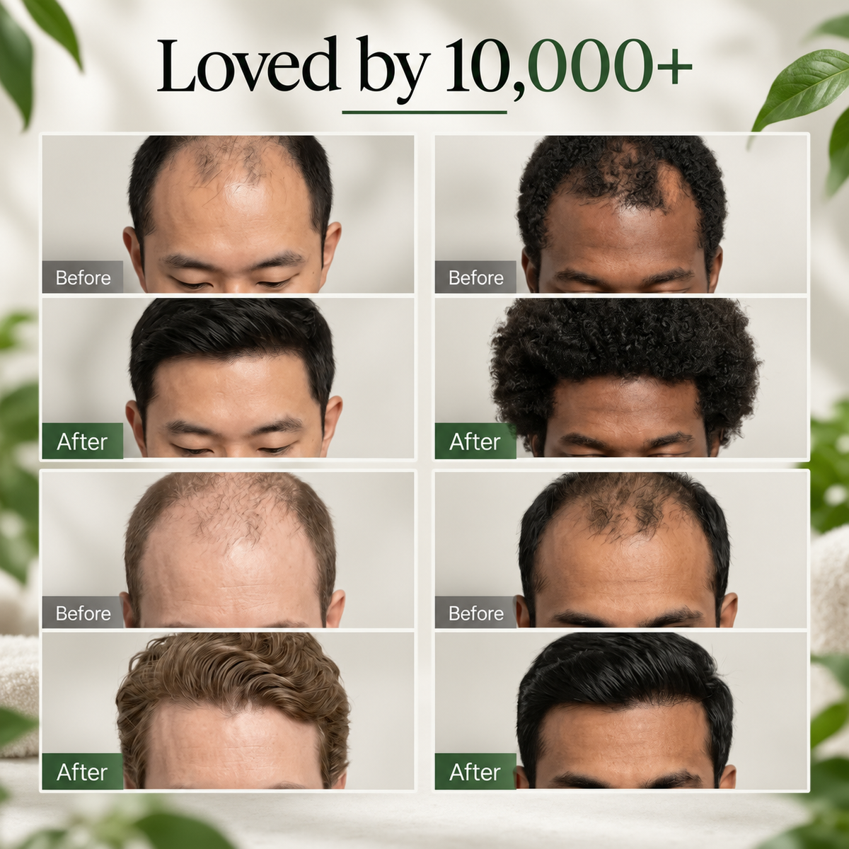 Folivor™ -  Healthy-looking hair starts at the scalp