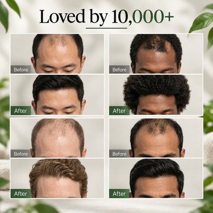 Folivor™ -  Healthy-looking hair starts at the scalp