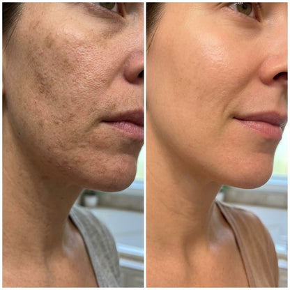 Svelora™ Exfoliating Body Stick